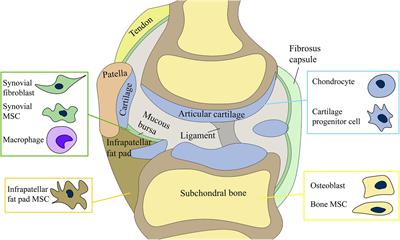 Kenőcs a térd osteoarthritisének kezelésére, Osteoarthritis - mi ez, a kezelés és a tünetek